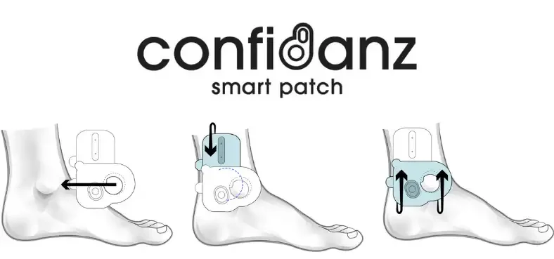 Confidanz™ Smart Patch is an investigational device being used in clinical trials