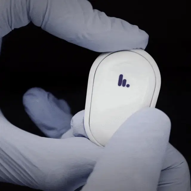 Nutromics patch tracks multiple, crucial targets continuously and in real-time, giving clinicians critical, personalized insights