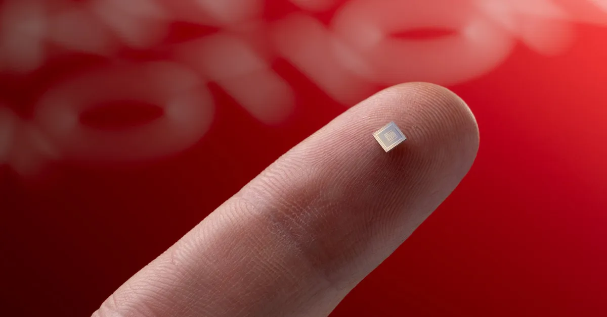 The tiny QPU chip at the heart of Quantum Motion’s silicon spin system